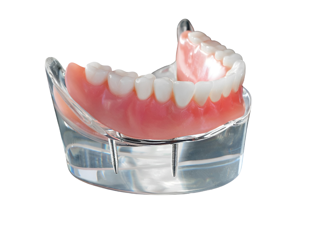 Протезы зубные акриловые